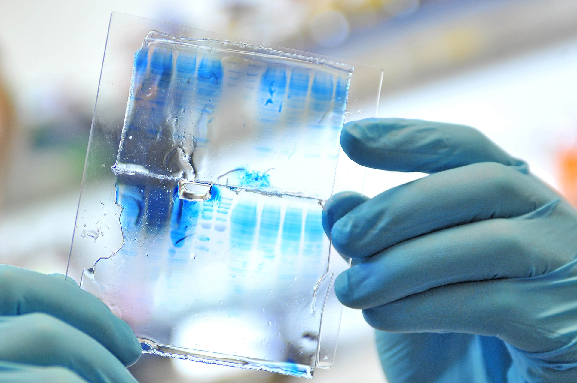 Gel electrophoresis, in which proteins can be separated with the help of polyacrylamide gel