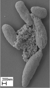 Pseudomonas putida in Anwesenheit von Zinkoxid-Nanopartikeln  