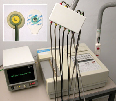 Saug- und Klebeelektrode eines konventionellen EKG-Systems
