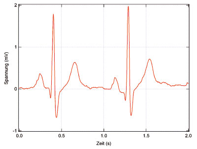 Elektrokardiogramm eines gesunden Menschen