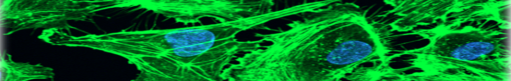 Fluoreszenz-Mikroskopie einer menschlichen Endothelzelle mit Phalloidin-Alexa 488-detektiertem Aktinzytoskelett und DAPI-markiertem Zellkern