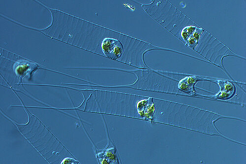 Kieselalgen im Spielmannsteich