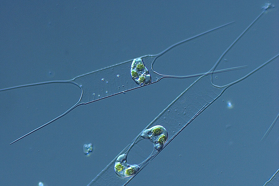 Kieselalgenblüte (Acanthoceras zachariasii) im Braunschweiger Spielmannsteich.