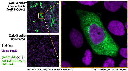 Abcalis antibodies binding to SARS-CoV-2 N-Protein