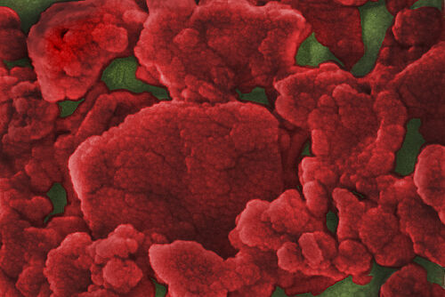 Blick durch die Feldemissions-Rasterelektronenmikroskopie: Das Bild zeigt die Verteilung von Nanokompositen auf der Oberfläche von Asphaltbindern.