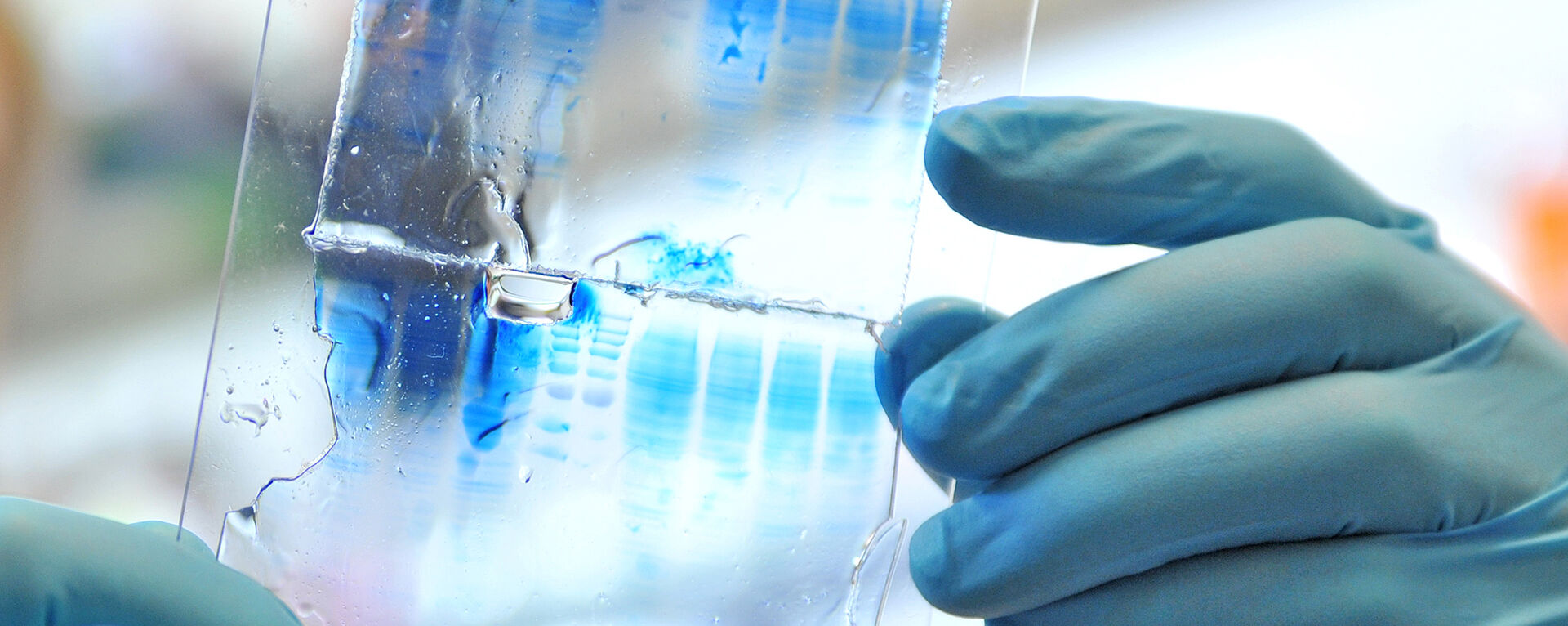 Gel electrophoresis, in which proteins can be separated with the help of polyacrylamide gel