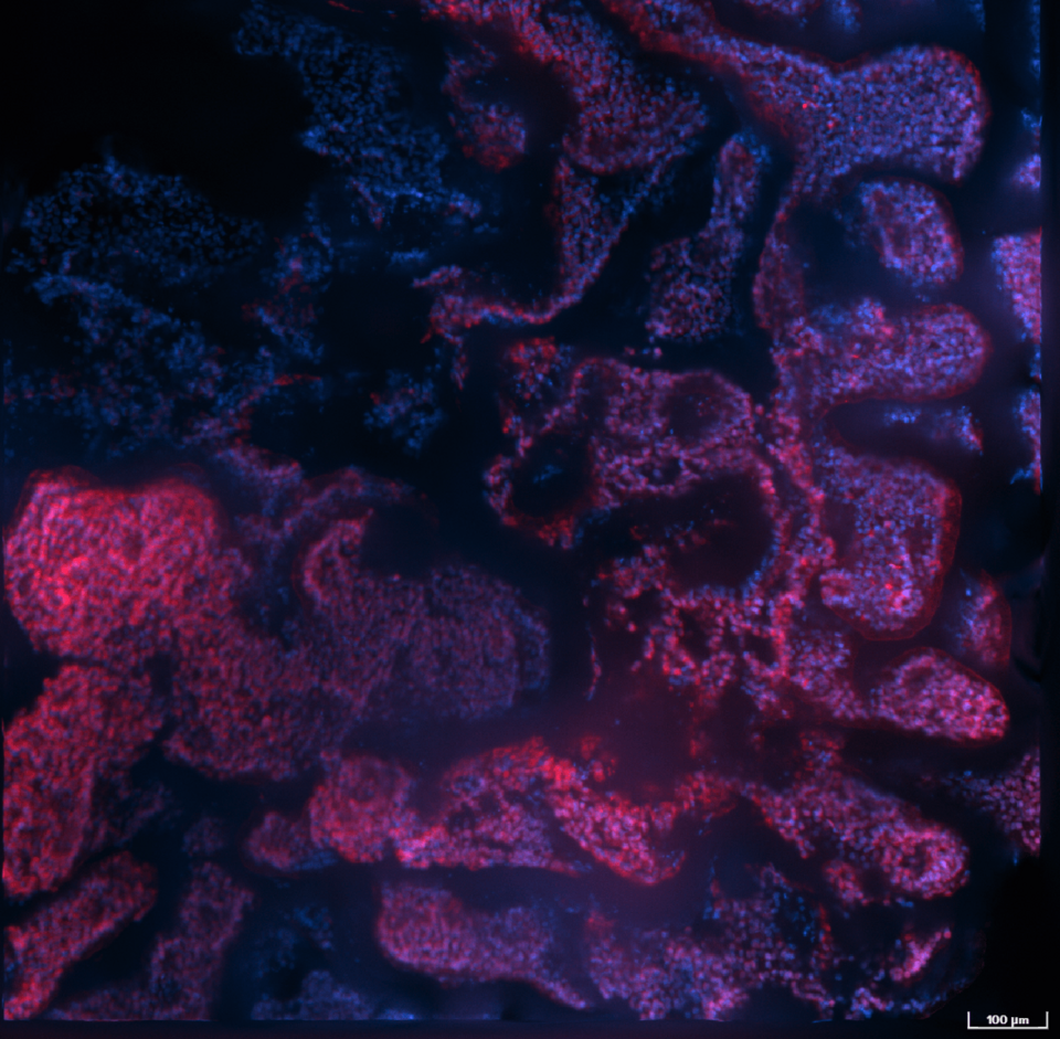 Oberfläche eines Lungenorganoids