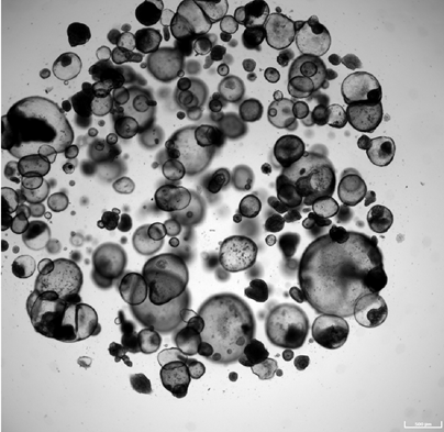 Darmorganoide