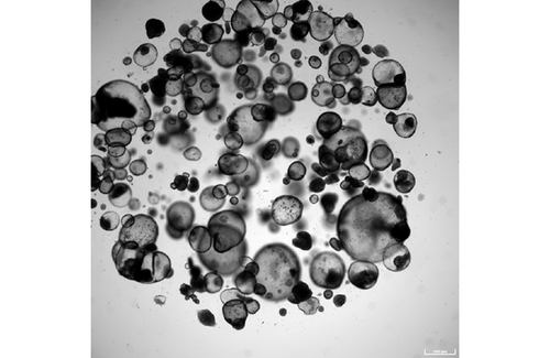 Darmorganoide