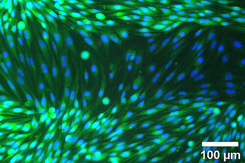 Angefärbte humane Endothelzellen  - Bild des Monats März 2023
