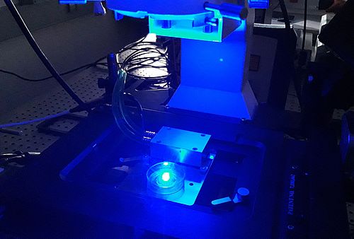 Zellprobe unter einem Fluoreszenzmikroskop zur Untersuchung von Proteinen in lebenden Zellen.