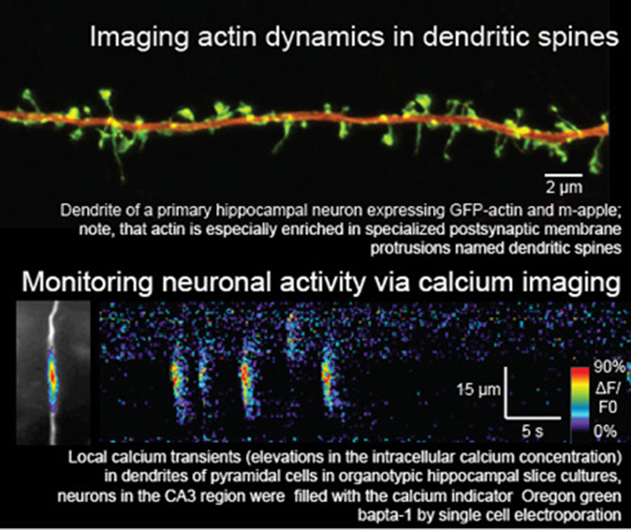 Imaging actin dynamics in dendritic spines