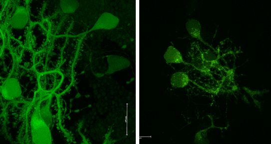 Visualisierung von Autophagosomen in Neuronen des Zebrafisches