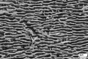 Nanoporöse Metallmembran