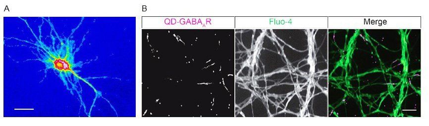 Calcium imaging