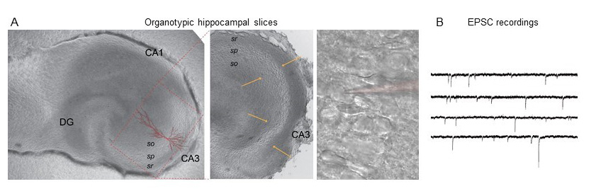 Organotypic hippocampal slices