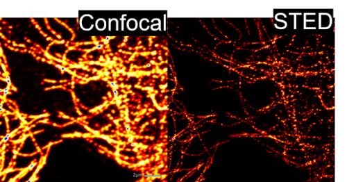 herkömmliches (links) und superaufgelöstes (rechts) Bild des fluoreszenzmarkierten Tubulin-Cytoskeletts einer Säugerzelle