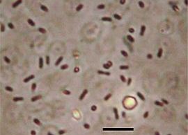 Dinoroseobacter shibae